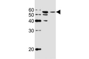 Western blot analysis of lysate from MCF-7, T47D cell line (left to right) using ALDH6A1 antibody at 1:1000 for each lane. (ALDH6A1 antibody)