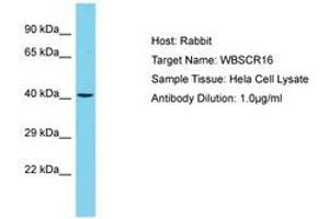 WBSCR16 抗体  (AA 115-164)