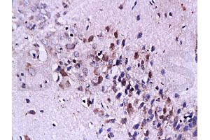 Formalin-fixed and paraffin embedded: rat brain tissue labeled with Anti-FasL Polyclonal Antibody, Unconjugated (ABIN726410) at 1:200, followed by conjugation to the secondary antibody and DAB staining (FASL antibody  (AA 196-281))