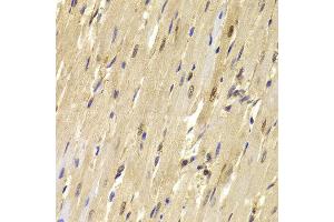 Immunohistochemistry of paraffin-embedded Mouse heart using TOPBP1 antibody at dilution of 1:100 (x40 lens). (TOPBP1 antibody)