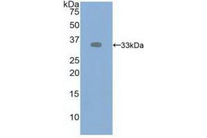 Western blot analysis of recombinant Human VEGFR2. (VEGFR2/CD309 antibody  (AA 46-320))