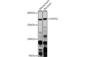 Western blot analysis of extracts of various cell lines, using YE antibody (ABIN7271413) at 1:1000 dilution. (YEATS2 antibody)
