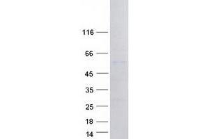 Western Blotting (WB) image for Paired Box 3 (PAX3) protein (Myc-DYKDDDDK Tag) (ABIN2728311)