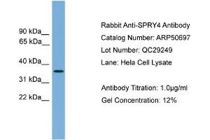 WB Suggested Anti-SPRY4  Antibody Titration: 0. (SPRY4 antibody  (Middle Region))