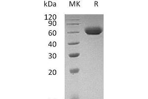 Western Blotting (WB) image for Lymphocyte-Activation Gene 3 (LAG3) (Active) protein (His tag) (ABIN7320610) (LAG3 Protein (His tag))