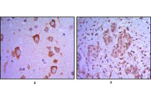 Immunohistochemical analysis of paraffin-embedded human brain tissue (A) and breast tumor (B) uing ETS1 mouse mAb. (ETS1 antibody)