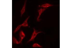 ABIN6269328 staining NIH-3T3 by IF/ICC. (PKC delta antibody  (C-Term))