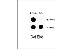 Dot blot analysis of anti-Phospho-P53-S9 Antibody (ABIN1881624 and ABIN2850450) on nitrocellulose membrane. (p53 antibody  (pSer9))