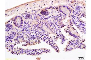 Formalin-fixed and paraffin embedded mouse intestine labeled with Rabbit Anti LI-cadherin Polyclonal Antibody, Unconjugated (ABIN732128) at 1:200 followed by conjugation to the secondary antibody and DAB staining (LI Cadherin antibody  (AA 101-200))