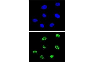 Confocal immunofluorescent analysis of TP73 Antibody (Center) (ABIN652829 and ABIN2842541) with 293 cell followed by Alexa Fluor® 488-conjugated goat anti-rabbit lgG (green). (Tumor Protein p73 antibody  (AA 288-317))