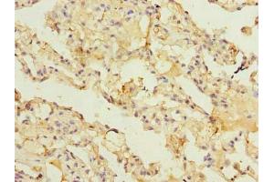 Immunohistochemistry of paraffin-embedded human lung tissue using ABIN7143477 at dilution of 1:100 (ARL11 antibody  (AA 2-196))