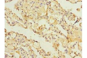 Immunohistochemistry of paraffin-embedded human lung tissue using ABIN7143477 at dilution of 1:100 (ARL11 antibody  (AA 2-196))