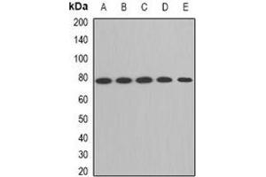 Western blot analysis of ACAS2 expression in HepG2 (A), SW620 (B), mouse liver (C), mouse kidney (D), rat brain (E) whole cell lysates. (ACSS2 antibody)