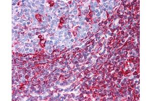 Vimentin antibody was used for immunohistochemistry at a concentration of 4-8 ug/ml. (Vimentin antibody  (C-Term))