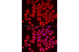 Immunofluorescence analysis of U2OS cell using DCAF7 antibody. (DCAF7 antibody)