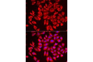 Immunofluorescence analysis of U2OS cell using DCAF7 antibody.