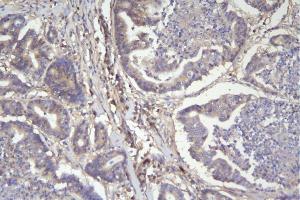 IHC analysis of CD46 using anti-CD46 antibody (ABIN7602758). (CD46 antibody  (C-Term))