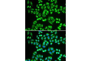 Immunofluorescence analysis of HeLa cell using SHMT2 antibody. (SHMT2 antibody)