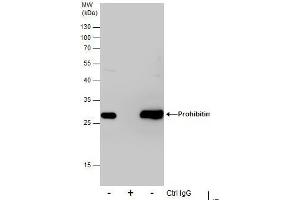 IP Image Immunoprecipitation of Prohibitin protein from 293T whole cell extracts using 5 μg of Prohibitin antibody, Western blot analysis was performed using Prohibitin antibody, EasyBlot anti-Rabbit IgG  was used as a secondary reagent. (Prohibitin antibody)