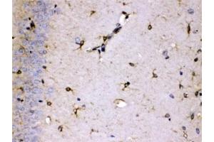 IHC testing of FFPE rat brain with ALDH7A1 antibody at 1ug/ml. (ALDH7A1 antibody  (AA 333-369))