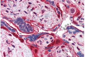 Human Placenta (formalin-fixed, paraffin-embedded) stained with ANXA11 antibody ABIN351460 at 3. (Annexin A11 antibody  (AA 8-20))