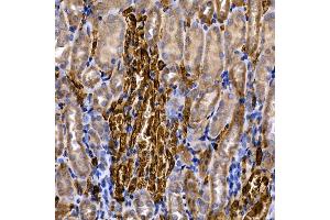 Immunohistochemistry (IHC) image for anti-Caspase 8 (CASP8) (AA 1-479) antibody (ABIN6137970)