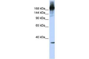 PRPF8 antibody used at 1 ug/ml to detect target protein. (PRPF8 antibody)