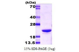 SDS-PAGE (SDS) image for Crystallin, alpha B (CRYAB) (AA 1-175) protein (ABIN666647) (CRYAB Protein (AA 1-175))