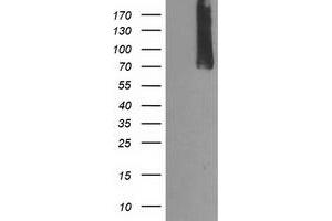 Western Blotting (WB) image for anti-Calpain 9 (CAPN9) antibody (ABIN1497092) (Calpain 9 antibody)