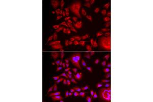 Immunofluorescence analysis of HeLa cell using BLMH antibody. (BLMH antibody)