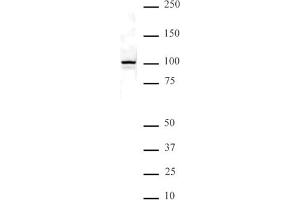 NFkB p100 pAb tested by Western blot. (NFKB2 antibody  (C-Term))