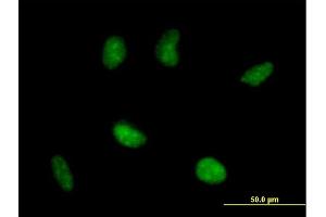 Immunofluorescence of purified MaxPab antibody to RAD51AP1 on HeLa cell. (RAD51AP1 antibody  (AA 1-335))