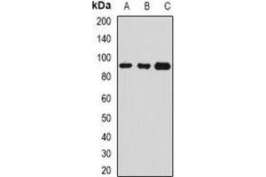 Western blot analysis of Serpin G1 expression in SW480 (A), MCF7 (B), HepG2 (C) whole cell lysates. (SERPING1 antibody)
