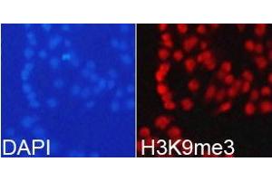 Immunofluorescence analysis of 293T cell using H3K9me3antibody. (Histone 3 antibody  (H3K9me3))