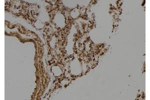 ABIN6275649 at 1/100 staining Rat lung tissue by IHC-P. (Ubiquilin 3 antibody  (Internal Region))