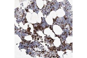 Immunohistochemical staining (Formalin-fixed paraffin-embedded sections) of human bone marrow with SIGLEC10 polyclonal antibody  shows strong cytoplasmic positivity in subsets of cells.