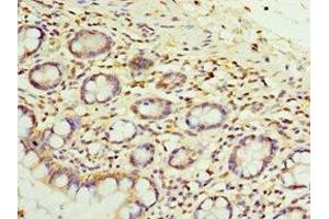 Immunohistochemistry of paraffin-embedded human small intestine tissue using ABIN7152050 at dilution of 1:100 (SULT1E1 antibody  (AA 140-294))
