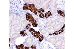 Immunohistochemistry (IHC) image for anti-Calbindin (CALB1) (AA 2-175) antibody (ABIN3030248)