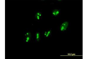 Immunofluorescence of purified MaxPab antibody to PARN on HeLa cell.