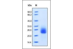 SDS-PAGE (SDS) image for Fms-Related tyrosine Kinase 3 Ligand (FLT3LG) (AA 27-185) protein (ABIN2181107) (FLT3LG Protein (AA 27-185))