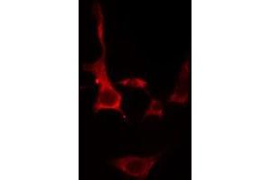 ABIN6275701 staining  Hela cells by IF/ICC. (SLC39A1 antibody  (Internal Region))