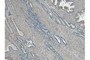 ABIN570714 (5 μg/mL) staining of paraffin embedded Human Prostate. (CEP290 antibody  (Internal Region))