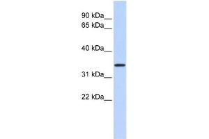 WB Suggested Anti-CCDC90A Antibody Titration:  0. (CCDC90A antibody  (Middle Region))