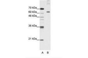 Image no. 2 for anti-Pumilio RNA Binding Family Member 3 (PUM3) (AA 61-110) antibody (ABIN203236) (KIAA0020 antibody  (AA 61-110))