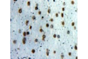 Immunohistochemistry (IHC) image for anti-Transcription Elongation Factor B (SIII), Polypeptide 3 (110kDa, Elongin A) (TCEB3) (AA 200-344) antibody (ABIN1858711)