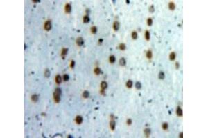 Used in DAB staining on fromalin fixed paraffin-embedded Brain tissue (TCEB3 antibody  (AA 200-344))