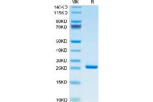 CRP Protein (AA 19-224) (His tag)