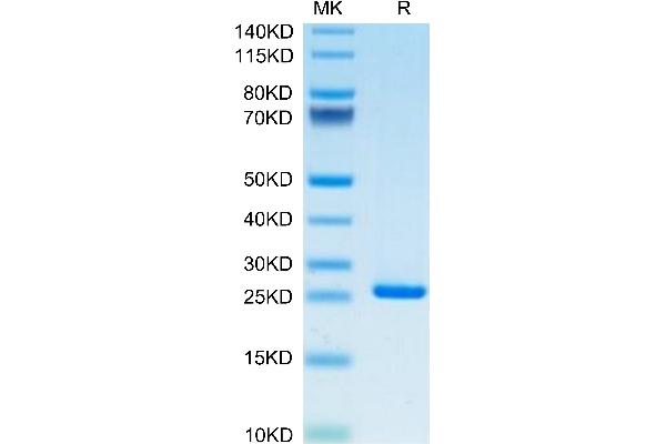 CRP Protein (AA 19-224) (His tag)