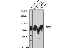 Western blot analysis of extracts of various cell lines, using  antibody (ABIN6131412, ABIN6136470, ABIN6136471 and ABIN6217898) at 1:3000 dilution. (ACSS3 antibody  (AA 30-280))