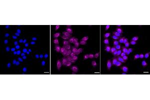 anti-Mechanistic Target of Rapamycin (serine/threonine Kinase) (mTOR) antibody